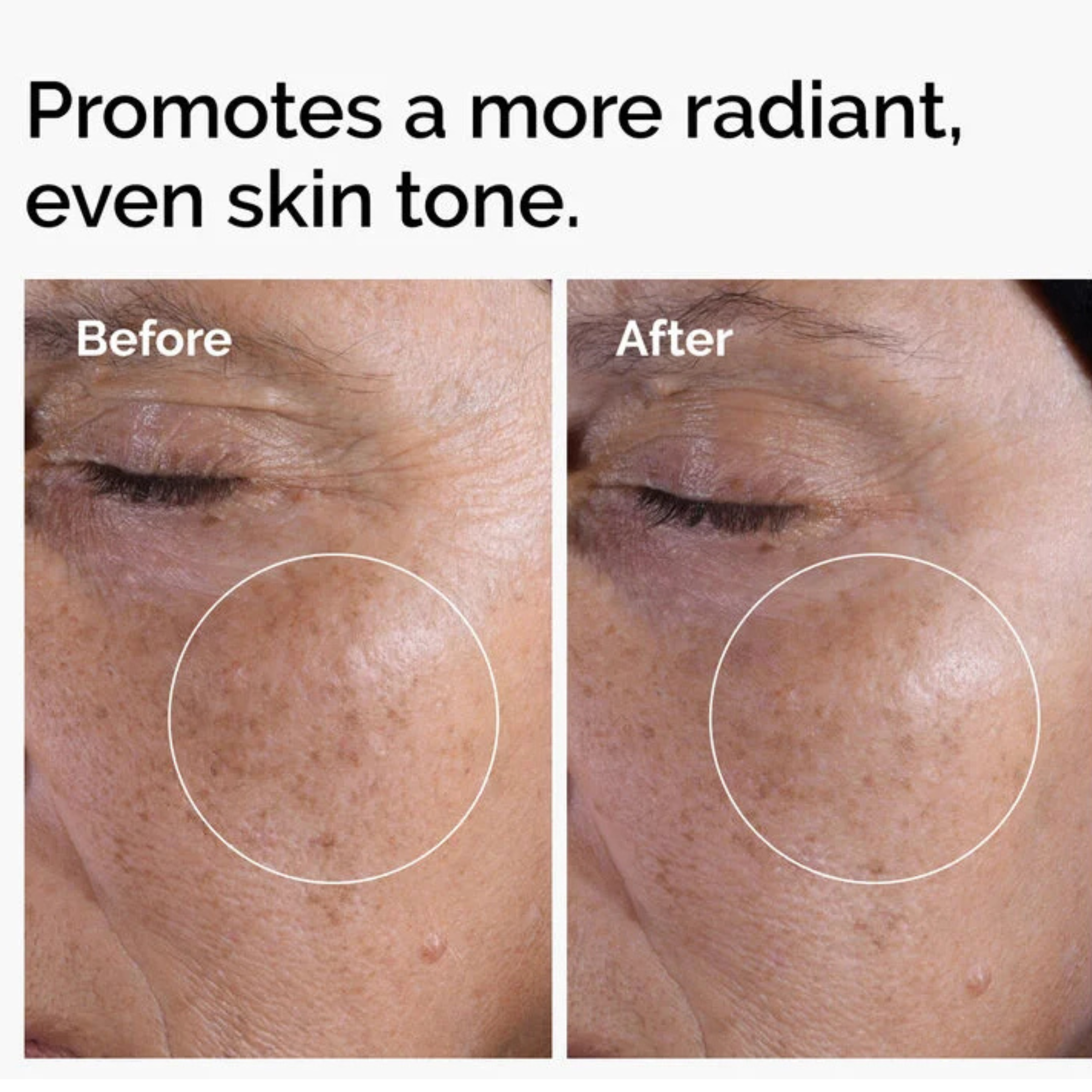 The ordinary - Glycolic Acid 7% Exfoliating Toner (pH 3.6)