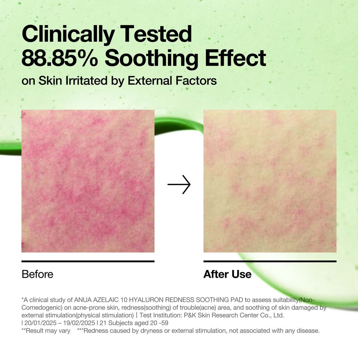 Anua - Azelaic 10 Hyaluron Redness Soothing Pads (230ml/7.77 fl.oz.)