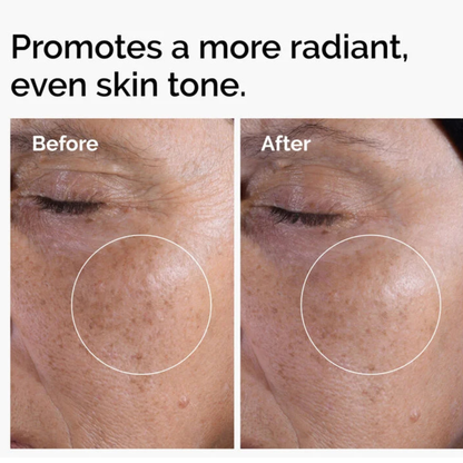 The ordinary - Glycolic Acid 7% Exfoliating Toner (pH 3.6)