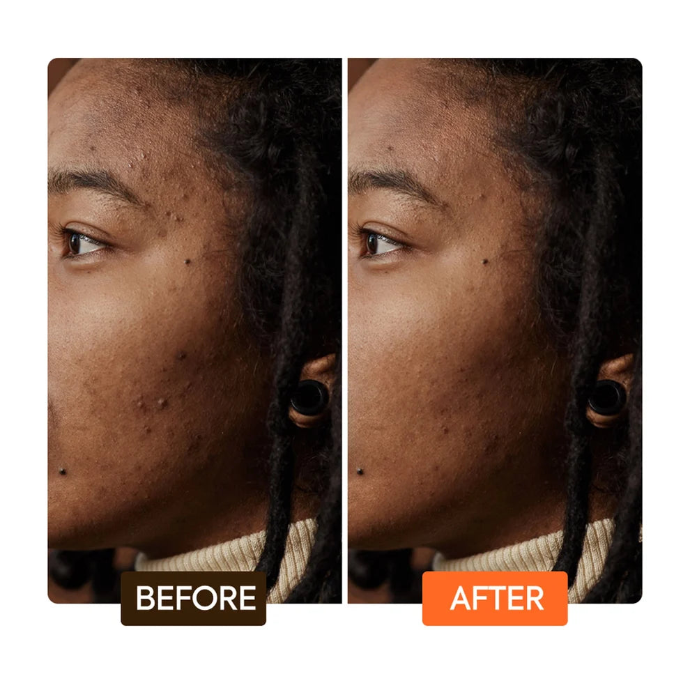 Makari - Extreme Argan &amp; Carrot Oil Dark Spot Corrector Serum (1.7oz/50ml)