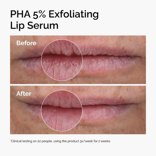 The Ordinary - PHA 5% Exfoliating Lip Serum (15ml)